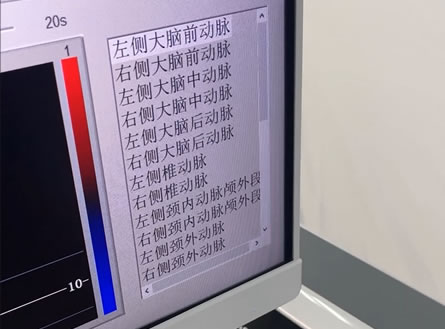 超聲經顱多普勒EXP-9D使用教程