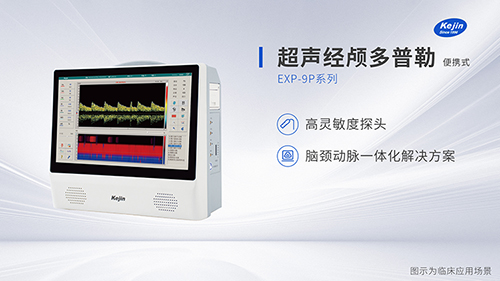 國(guó)產(chǎn)超聲經(jīng)顱多普勒廠家