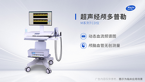 超聲經顱多普勒 tcd 是檢測什么的